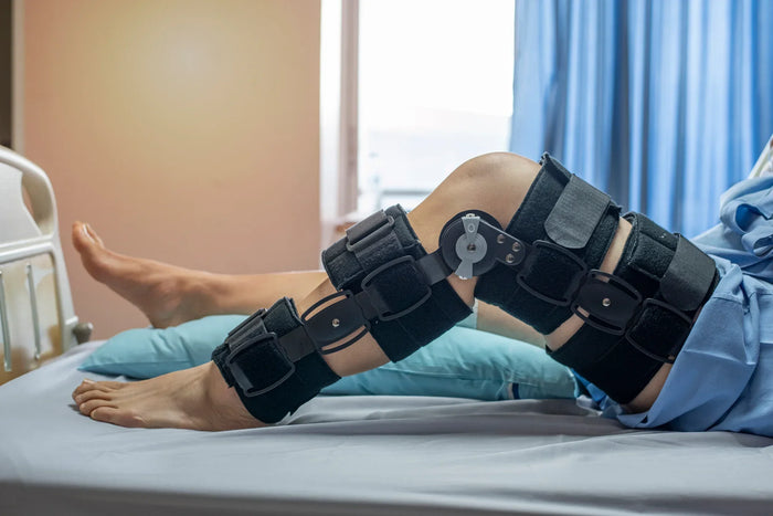 Recovery from ACL Surgery: Timeline & Tips