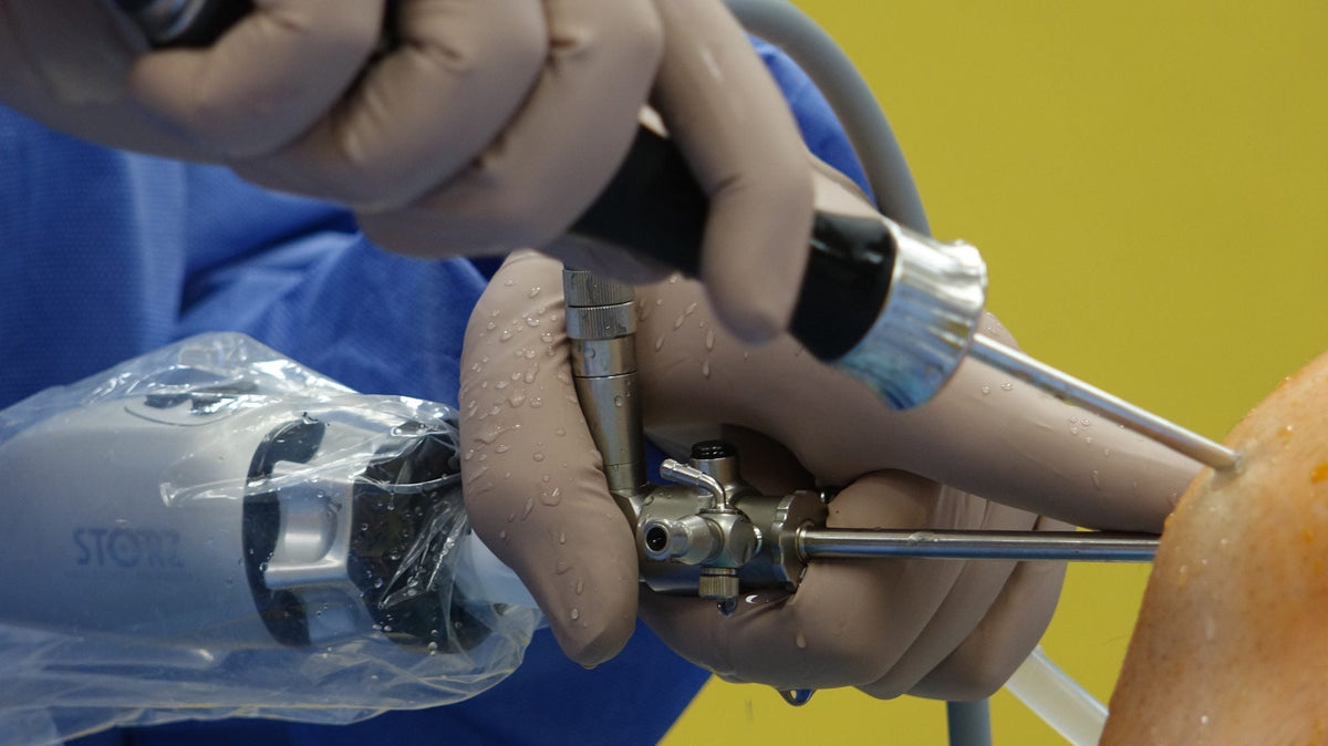 What changes in the first hours after ACL reconstruction